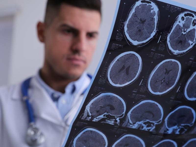 Saiba Tudo Sobre Esclerose de Cisto Hepático